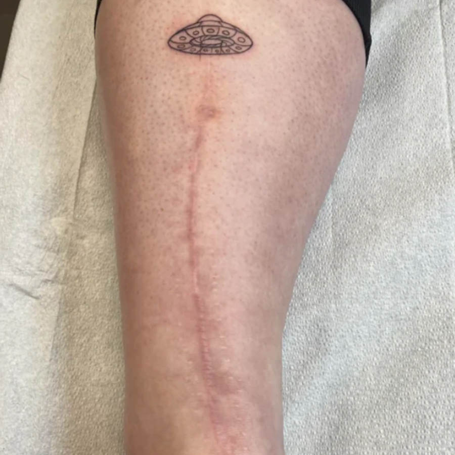 UFO surgery scar tattoo